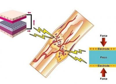 جریان الکتریسیته طبیعی استخوان ها به یاری ترمیم آن ها می آید